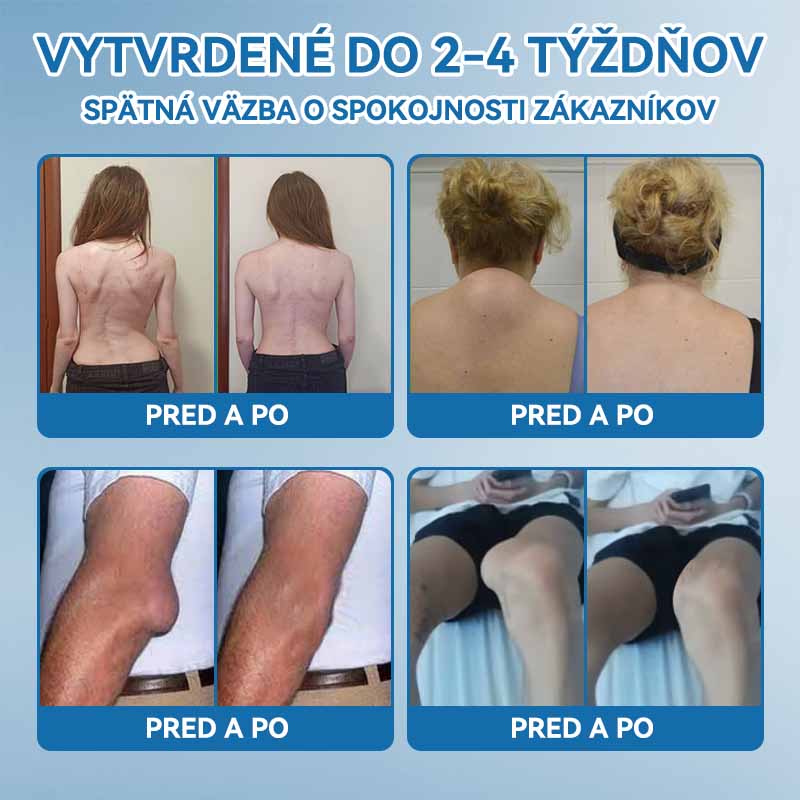 𝗣𝗶𝗰𝗱𝗼® 𝗕𝗣𝗖-𝟭𝟱𝟳 𝗞𝗿é𝗺 𝗻𝗮 𝗵𝗼𝗷𝗲𝗻𝗶𝗲 𝗸ĺ𝗯𝗼𝘃🦴Lieči artritídu, neuropatiu, reumu, športové zranenia a ďalšie ochorenia.⭐