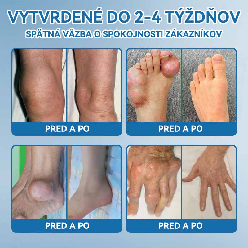 𝗣𝗶𝗰𝗱𝗼® 𝗕𝗣𝗖-𝟭𝟱𝟳 𝗞𝗿é𝗺 𝗻𝗮 𝗵𝗼𝗷𝗲𝗻𝗶𝗲 𝗸ĺ𝗯𝗼𝘃🦴Lieči artritídu, neuropatiu, reumu, športové zranenia a ďalšie ochorenia.⭐