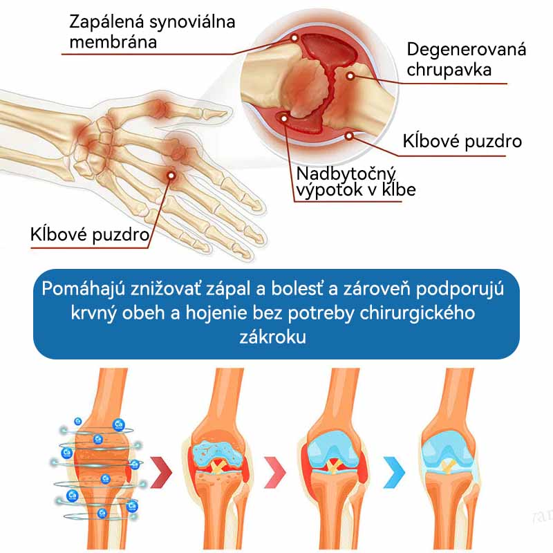 𝗣𝗶𝗰𝗱𝗼® 𝗕𝗣𝗖-𝟭𝟱𝟳 𝗞𝗿é𝗺 𝗻𝗮 𝗵𝗼𝗷𝗲𝗻𝗶𝗲 𝗸ĺ𝗯𝗼𝘃🦴Lieči artritídu, neuropatiu, reumu, športové zranenia a ďalšie ochorenia.⭐