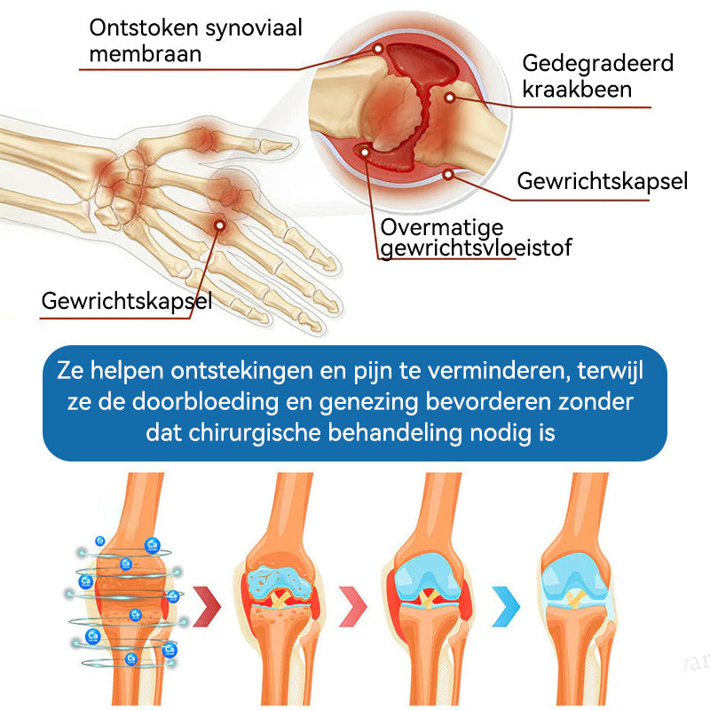 𝖯𝗂𝖼𝗱𝗼® BPC-157 Gewrichtsverzorgingscrème🦴Behandelt artritis, neuropathie, reuma, sportblessures en meer👩⚕️