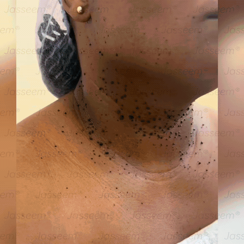 𝐉𝐚𝐬𝐬𝐞𝐞𝐦®👩⚕️Pokročilé neinvazívne CO₂ laserové pero na opravu pokožky – (Jemne odstraňuje bradavice, materské znamienka, starecké škvrny a kožné výrastky – bezbolestne a bez starostí!)💕