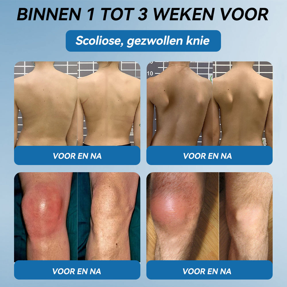 𝖯𝗂𝖼𝗱𝗼® BPC-157 Gewrichtsverzorgingscrème🦴Behandelt artritis, neuropathie, reuma, sportblessures en meer👩⚕️