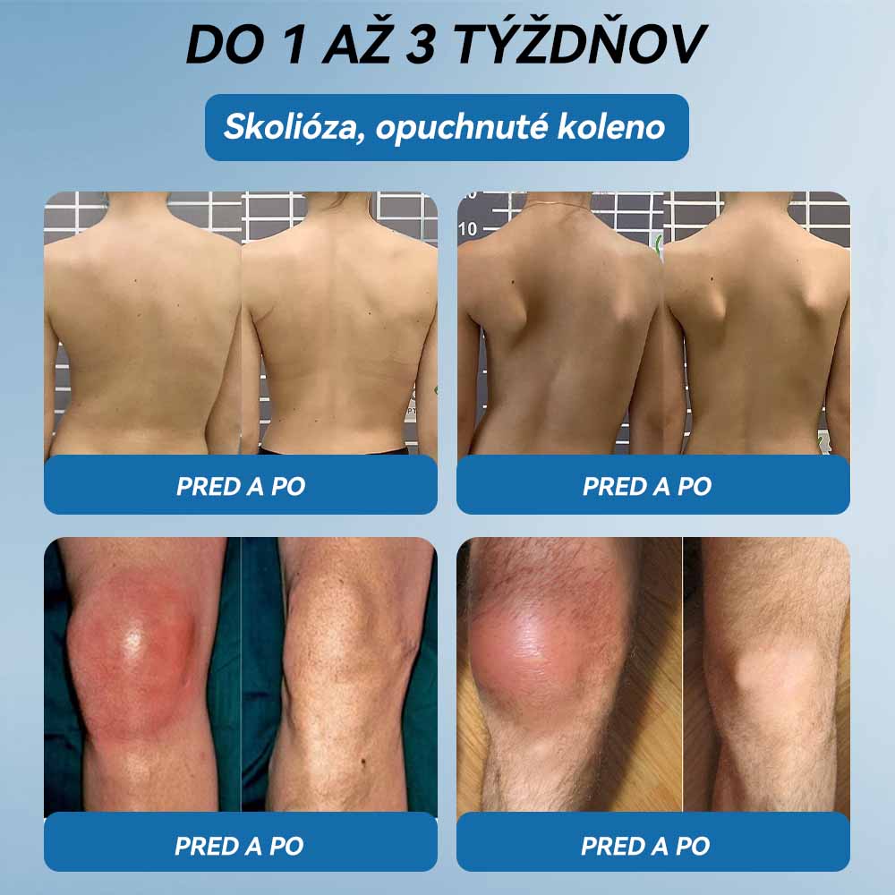 𝗣𝗶𝗰𝗱𝗼® 𝗕𝗣𝗖-𝟭𝟱𝟳 𝗞𝗿é𝗺 𝗻𝗮 𝗵𝗼𝗷𝗲𝗻𝗶𝗲 𝗸ĺ𝗯𝗼𝘃🦴Lieči artritídu, neuropatiu, reumu, športové zranenia a ďalšie ochorenia.⭐