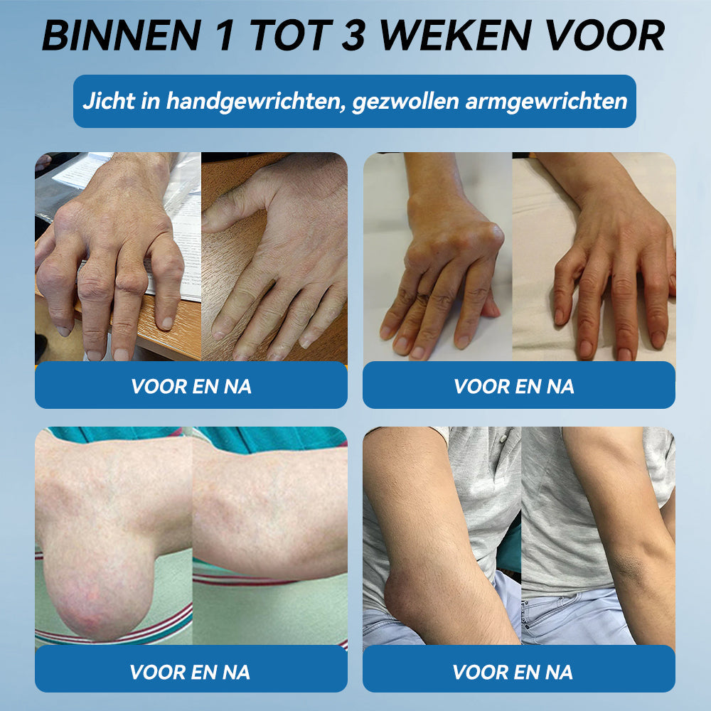 𝖯𝗂𝖼𝗱𝗼® BPC-157 Gewrichtsverzorgingscrème🦴Behandelt artritis, neuropathie, reuma, sportblessures en meer👩⚕️