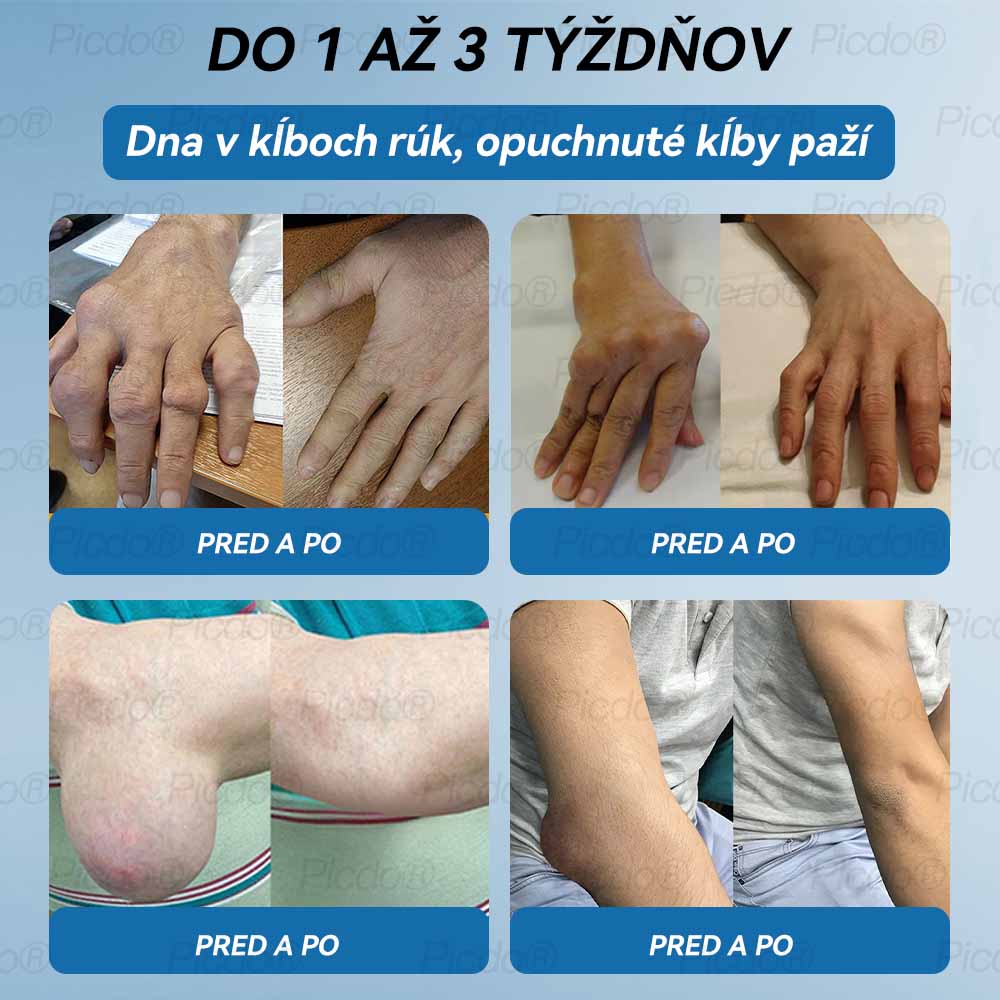 𝗣𝗶𝗰𝗱𝗼® 𝗕𝗣𝗖-𝟭𝟱𝟳 𝗞𝗿é𝗺 𝗻𝗮 𝗵𝗼𝗷𝗲𝗻𝗶𝗲 𝗸ĺ𝗯𝗼𝘃🦴Lieči artritídu, neuropatiu, reumu, športové zranenia a ďalšie ochorenia.⭐