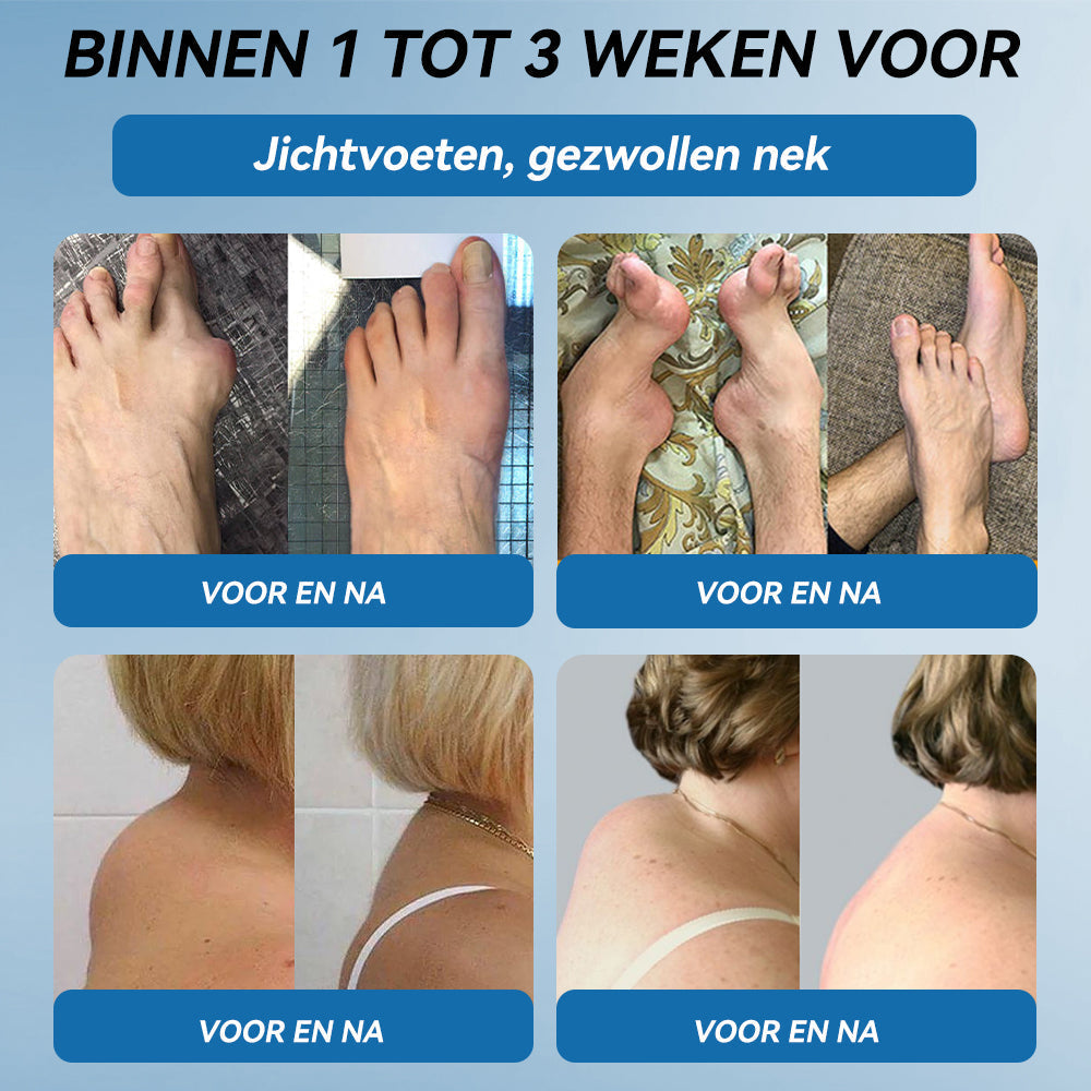 𝖯𝗂𝖼𝗱𝗼® BPC-157 Gewrichtsverzorgingscrème🦴Behandelt artritis, neuropathie, reuma, sportblessures en meer👩⚕️