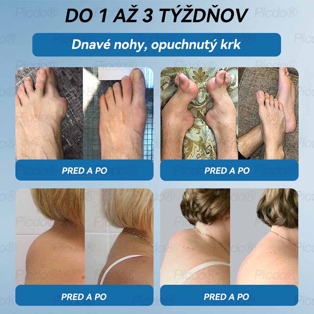 𝗣𝗶𝗰𝗱𝗼® 𝗕𝗣𝗖-𝟭𝟱𝟳 𝗞𝗿é𝗺 𝗻𝗮 𝗵𝗼𝗷𝗲𝗻𝗶𝗲 𝗸ĺ𝗯𝗼𝘃🦴Lieči artritídu, neuropatiu, reumu, športové zranenia a ďalšie ochorenia.⭐