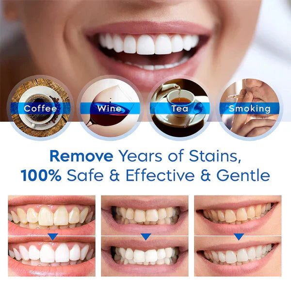 Dentora® 👩⚕️Odstráňte odolné škvrny a prirodzene vybielte zuby s Teeth Whitening Essence – bezpečné bielenie bez citlivosti pre žiarivý úsmev a svieži dych. 🦷