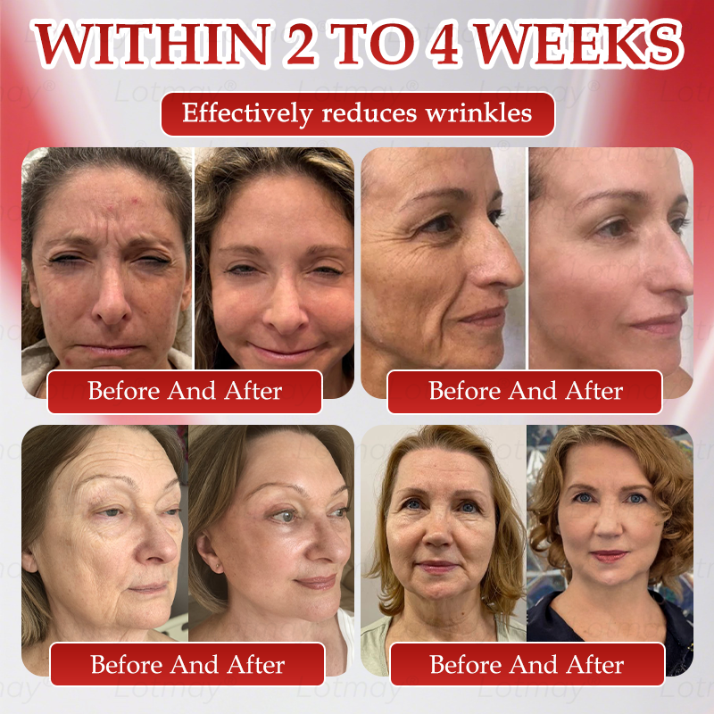 Vyrobené v USA👩⚕️ 𝐿𝑜𝑡𝑚𝑎𝑦® 𝑁𝑀𝑁 𝑁𝐴𝐷+ 𝐵𝑜𝑜𝑠𝑡 Spevňujúci a proti starnutiu perorálny roztok✅