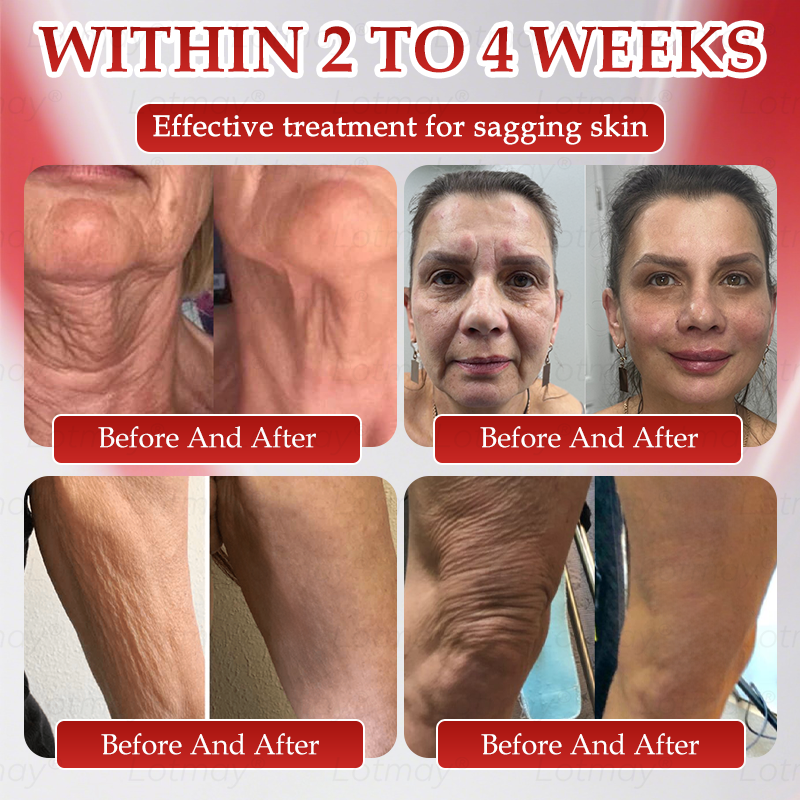 Vyrobené v USA👩⚕️ 𝐿𝑜𝑡𝑚𝑎𝑦® 𝑁𝑀𝑁 𝑁𝐴𝐷+ 𝐵𝑜𝑜𝑠𝑡 Spevňujúci a proti starnutiu perorálny roztok✅