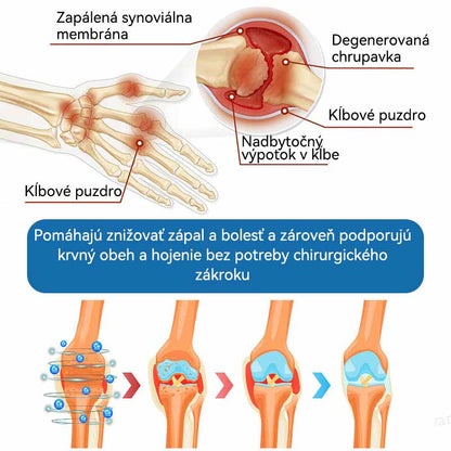 𝗣𝗶𝗰𝗱𝗼® 𝗕𝗣𝗖-𝟭𝟱𝟳 𝗞𝗿é𝗺 𝗻𝗮 𝗵𝗼𝗷𝗲𝗻𝗶𝗲 𝗸ĺ𝗯𝗼𝘃🦴Lieči artritídu, neuropatiu, reumu, športové zranenia a ďalšie ochorenia.⭐