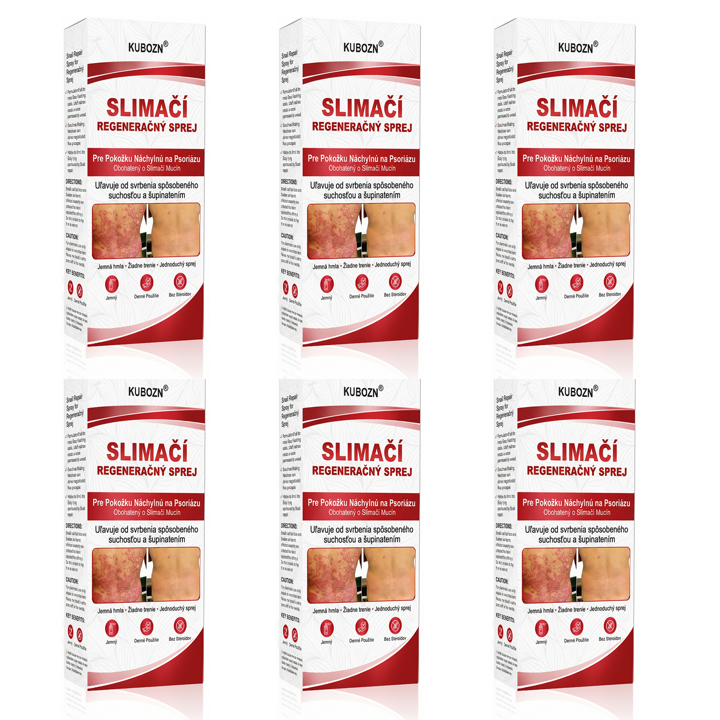 Florisma® 🥇🥬SLIMACİ REGENERAĞNY SPREJ  Na pokožku s psoriázou, svrbením a šupinatením