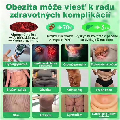 Možnosť platby na dobierku 【Posledný deň akcie: 70 % zľava】Florisma® 👩‍⚕️ Moringa & Berberín 10-v-1 Pokročilá Nano Mikroiigličková Náplasť Vhodné na obezitu, cukrovku, spánkovú apnoe a problémy so kĺbmi ✨