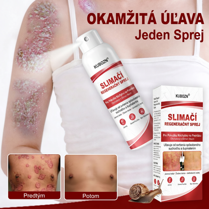 Florisma® 🥇🥬SLIMACİ REGENERAĞNY SPREJ  Na pokožku s psoriázou, svrbením a šupinatením