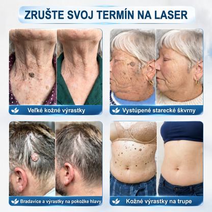 𝐏i𝐜𝐝o®💐 𝟕-𝐝ñ𝐨𝐯𝐲 𝐨𝐝𝐬𝐭𝐫𝐚ñ𝐨𝐯𝐚č 𝐤𝐨ž𝐧ý𝐜𝐡 𝐯ý𝐫𝐚𝐬𝐭𝐤𝐨𝐯 𝐚 š𝐤𝐯𝐫𝐧(Žiadna bolesť, nula rollerballov)🌹