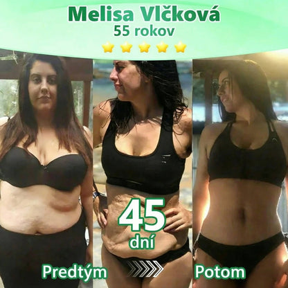Možnosť platby na dobierku 【Posledný deň akcie: 70 % zľava】Florisma® 👩‍⚕️ Moringa & Berberín 10-v-1 Pokročilá Nano Mikroiigličková Náplasť Vhodné na obezitu, cukrovku, spánkovú apnoe a problémy so kĺbmi ✨