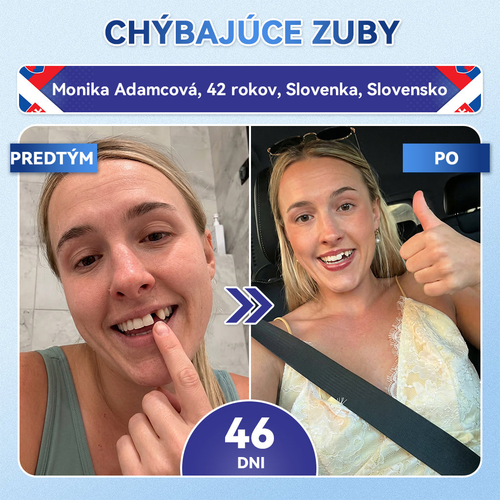 🦷𝐆𝐥𝐢𝐦𝐦𝐞𝐫𝐥𝐲® Tideglusib zuby a dasna Opravná náplasť s mikroihlami  | Pokročilé zubné pásiky s aktiváciou kmeňových buniek (obnova skloviny a dentínu • posilnenie ďasien • odstránenie zubného kameňa a zápachu • zastavenie citlivosti zubov)) 🎁