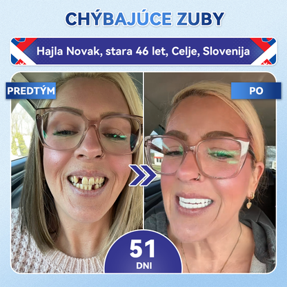 🦷𝐆𝐥𝐢𝐦𝐦𝐞𝐫𝐥𝐲® Tideglusib zuby a dasna Opravná náplasť s mikroihlami  | Pokročilé zubné pásiky s aktiváciou kmeňových buniek (obnova skloviny a dentínu • posilnenie ďasien • odstránenie zubného kameňa a zápachu • zastavenie citlivosti zubov)) 🎁