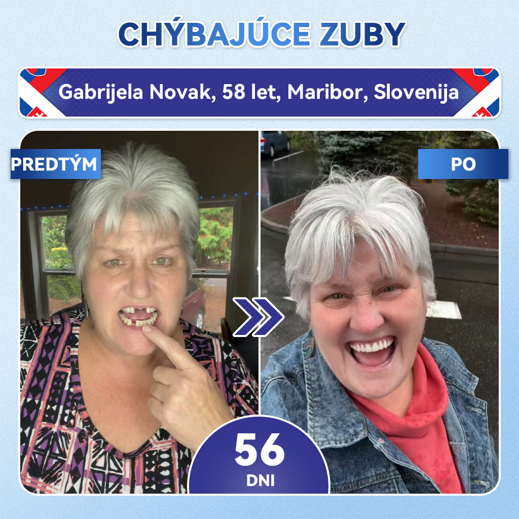 🦷𝐆𝐥𝐢𝐦𝐦𝐞𝐫𝐥𝐲® Tideglusib zuby a dasna Opravná náplasť s mikroihlami  | Pokročilé zubné pásiky s aktiváciou kmeňových buniek (obnova skloviny a dentínu • posilnenie ďasien • odstránenie zubného kameňa a zápachu • zastavenie citlivosti zubov)) 🎁