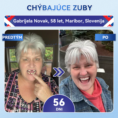 🦷𝐆𝐥𝐢𝐦𝐦𝐞𝐫𝐥𝐲® Tideglusib zuby a dasna Opravná náplasť s mikroihlami  | Pokročilé zubné pásiky s aktiváciou kmeňových buniek (obnova skloviny a dentínu • posilnenie ďasien • odstránenie zubného kameňa a zápachu • zastavenie citlivosti zubov)) 🎁