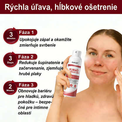Florisma® 🥇🥬SLIMACİ REGENERAĞNY SPREJ  Na pokožku s psoriázou, svrbením a šupinatením