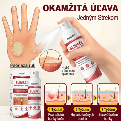 Florisma® 🥇🥬SLIMACİ REGENERAĞNY SPREJ  Na pokožku s psoriázou, svrbením a šupinatením