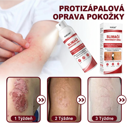 Florisma® 🥇🥬SLIMACİ REGENERAĞNY SPREJ  Na pokožku s psoriázou, svrbením a šupinatením