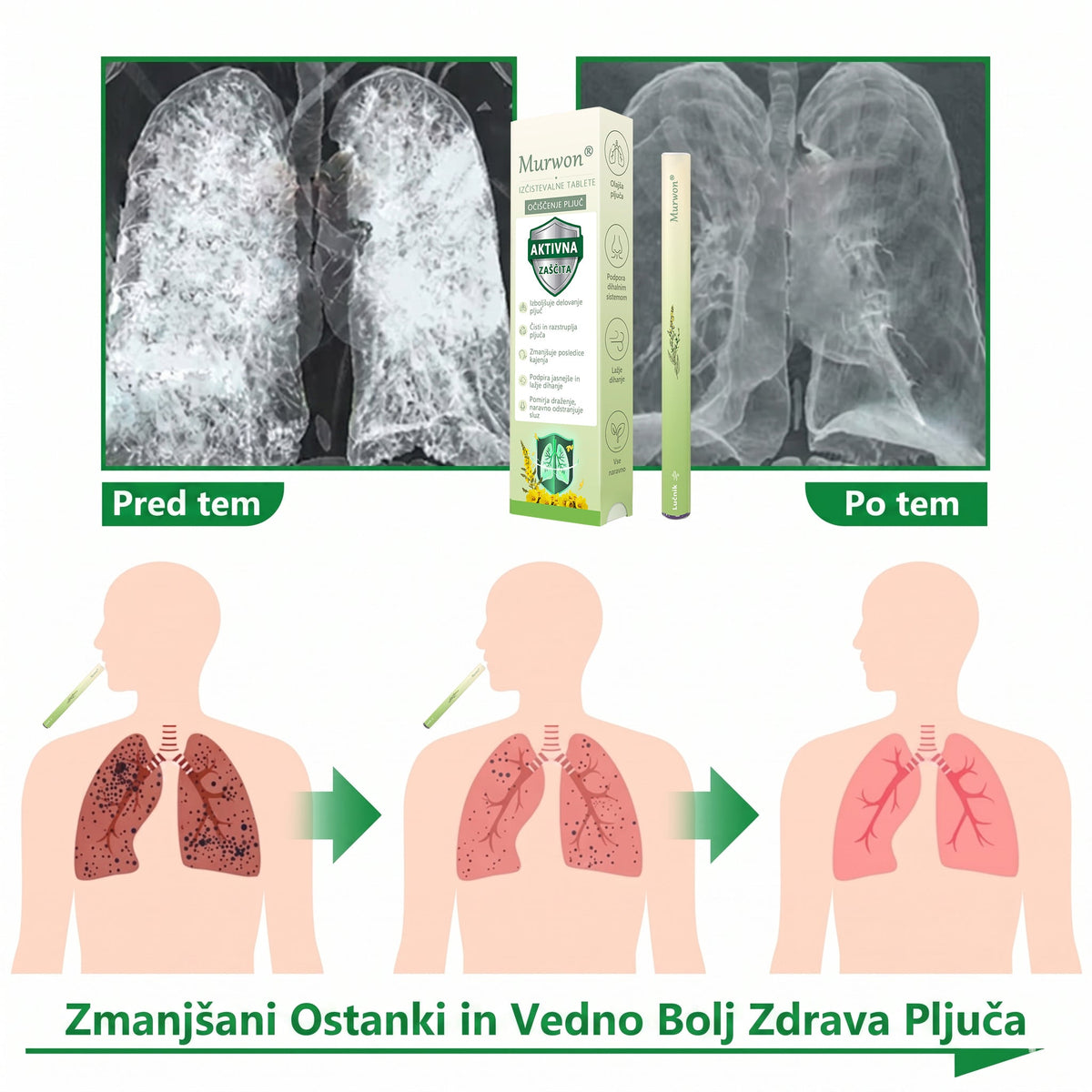 𝑮𝒍𝒊𝒎𝒎𝒆𝒓𝒍𝒚® bylinný parný inhalátor na prečistenie pľúc ❤️ (👨‍⚕️ Účinná pomoc pri kašli, zápale hrdla, ťažkostiach s dýchaním, tvorbe hlienu, upchatom nose, bronchitíde, alergických príznakoch a problémoch s pľúcami)